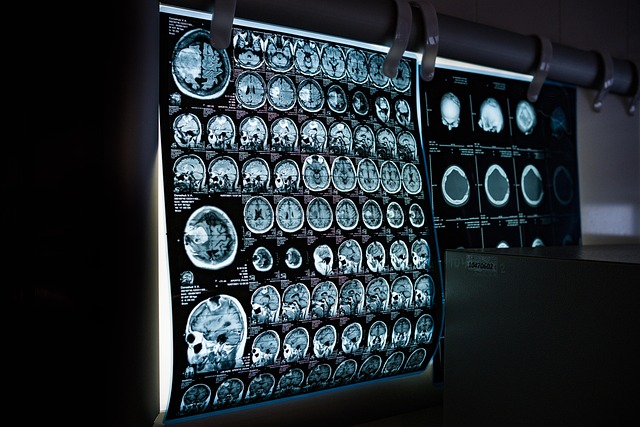 DEXA Scan Longevity Guide: Body Composition, Bone Health, and Metabolic Rate featured image